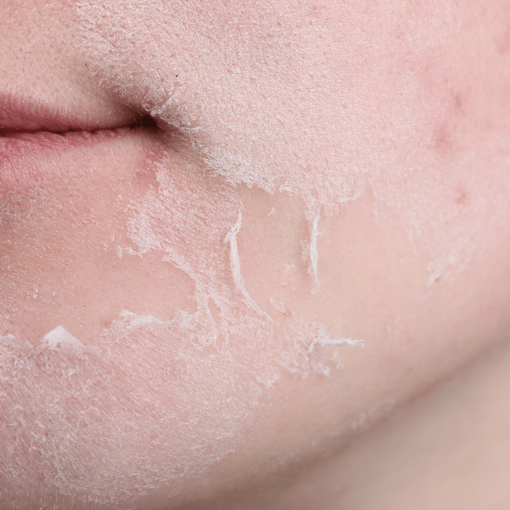 Blossom Kochhar Diamond Facial